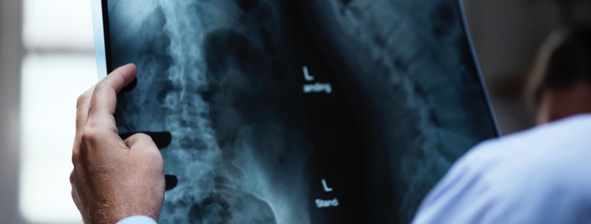 osteopathy X-ray