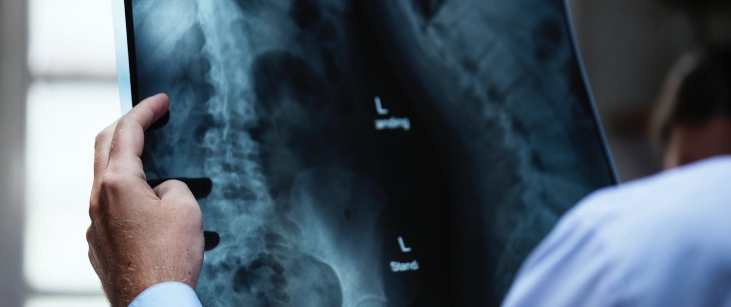 osteopathy X-ray